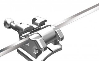 自锁托槽矫治技术 自锁陶瓷托槽矫正技术